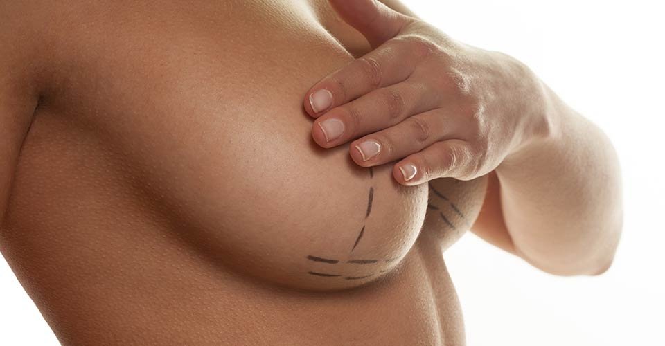  Tratament în premieră la Iaşi pentru femeile care au suferit mastectomii