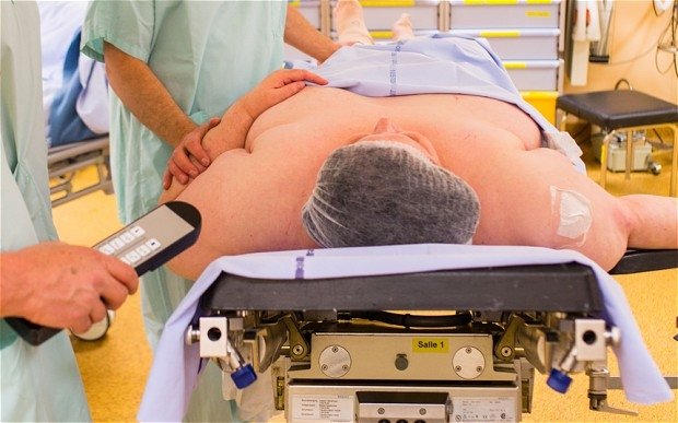  Bărbat de 300 kg adus la spital în Iaşi cu ajutorul oferit de 15 angajaţi SMURD