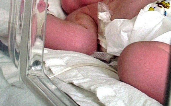  Băieţel de doar opt luni, diagnosticat cu boală genetică rară