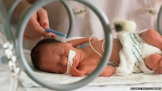  VEȘTI BUNE! Şanse la viaţă pentru trei bebeluşi din Iaşi cu malformaţii cardiace
