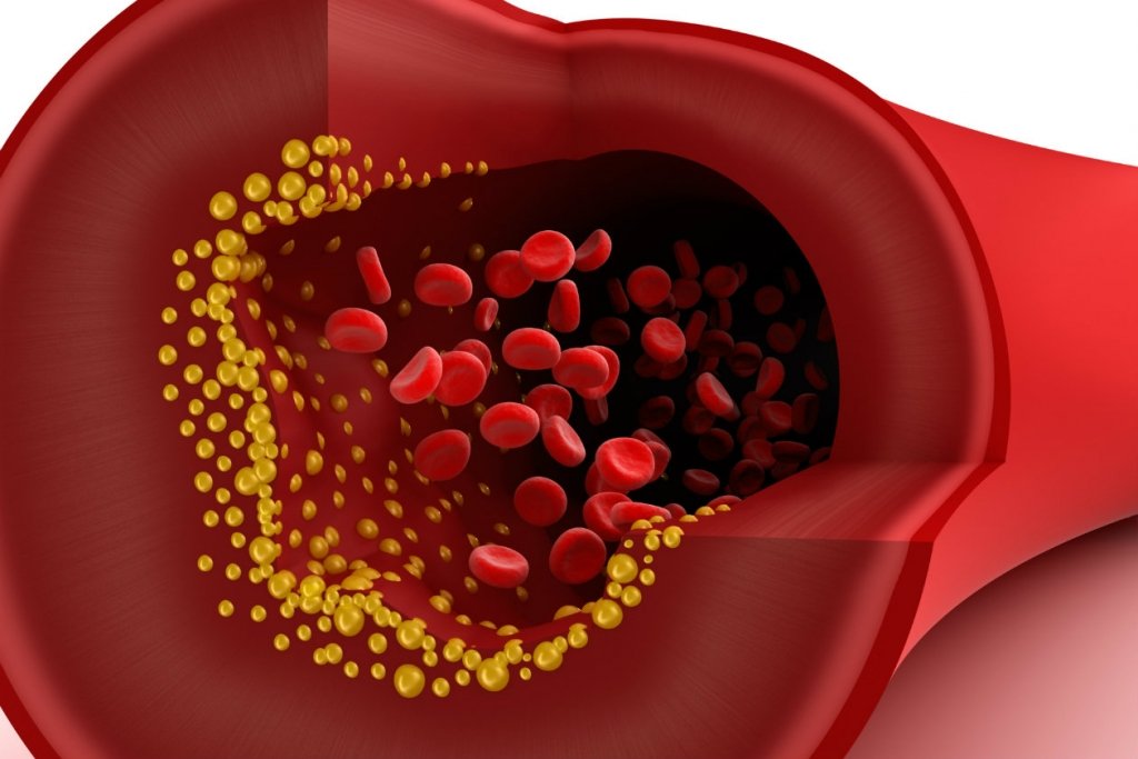 Care este nivelul optim de colesterol pe grupuri de vârstă