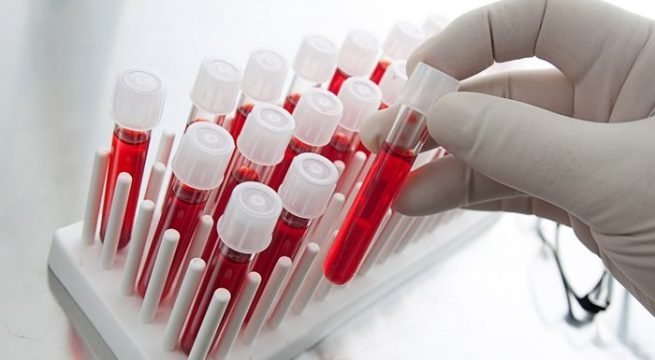  Studiu: un nou test de sânge poate depista tuberculoza în doar câteva ore