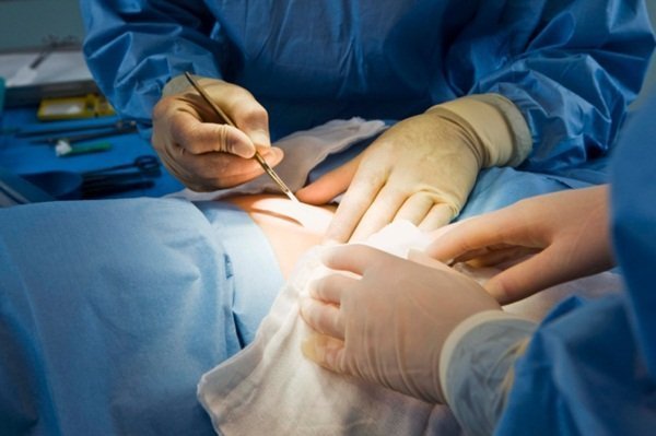  Trei transplanturi în două zile la Spitalul „Parhon”: De ce nu rămân ambii rinichi la Iaşi?