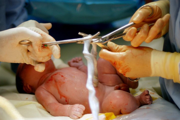  O româncă din Italia a refuzat la naştere să taie cordonul ombilical al nou-născutului