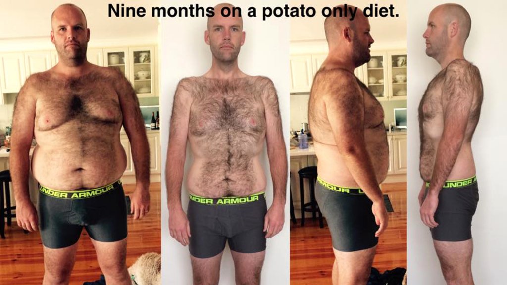  A slăbit 50 de kilograme după ce a ţinut o dietă bazată numai pe cartofi