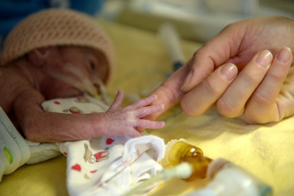  Părinte de prematur: copilul meu va fi bine?