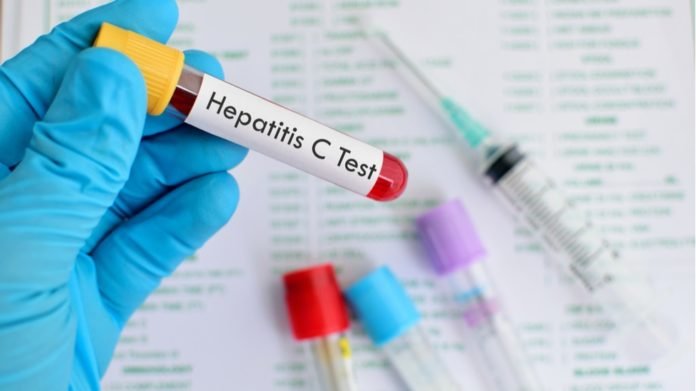  Trei scheme de tratament fără interferon pentru bolnavii de hepatită cronică