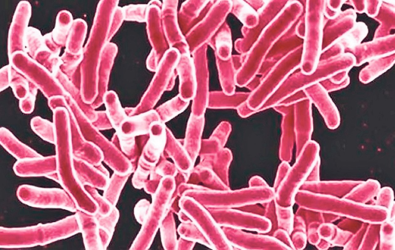  Tuberculoza la copii: Cât de grav este? Cât timp este contagios copilul?