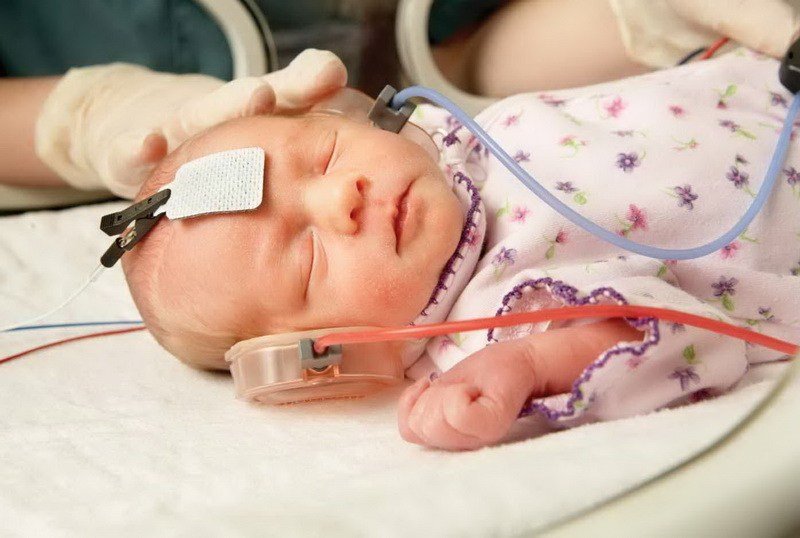  Screening pentru nou născuţi, în primele zile de viaţă, la Iaşi: două boli grave pot fi depistate precoce