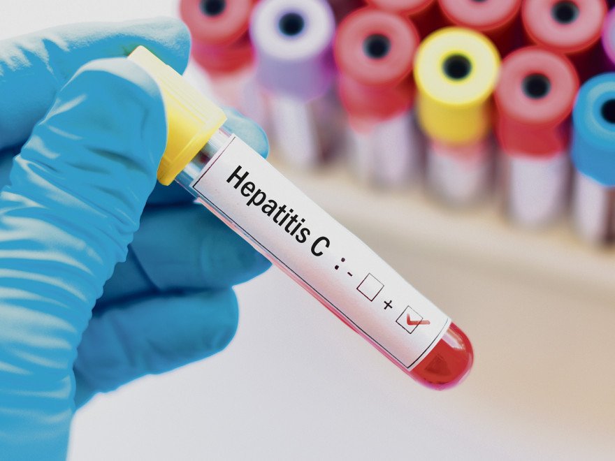  Trei sferturi dintre români nu s-au testat pentru hepatita C, deși o pot face gratuit