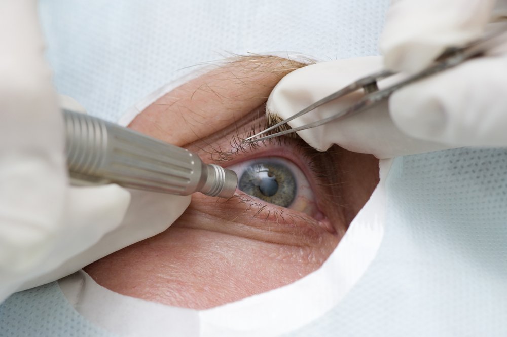  Cataracta: ce se întâmplă dacă se amână operaţia?