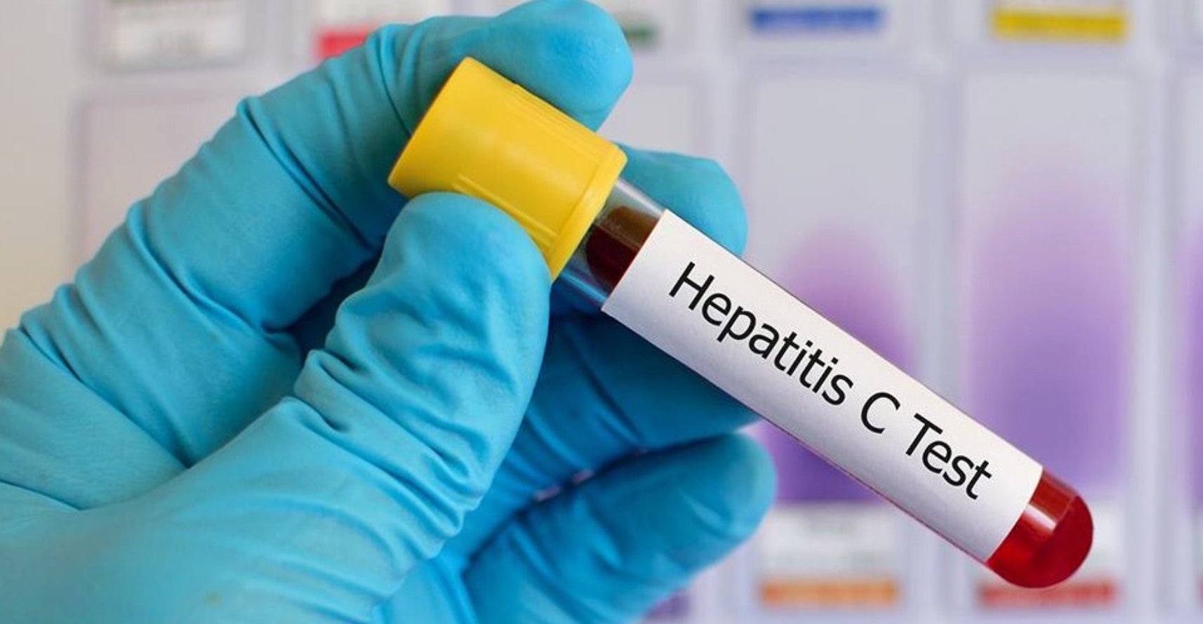  Două sute de ieşeni testaţi gratuit pentru hepatita C