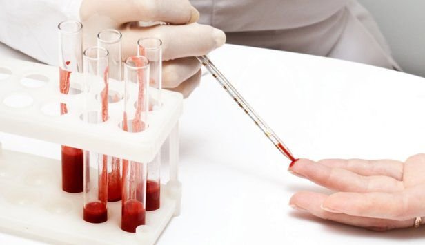  Studiu: Un simplu test de sânge ar putea dezvălui ritmul personal de îmbătrânire