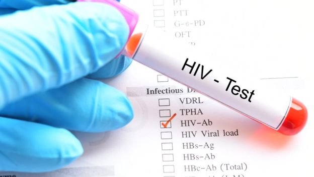  16 persoane cu HIV descoperite la Iaşi în primele 9 luni ale anului trecut