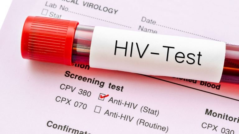  Sondaj: mulţi români nu ştiu cum se transmite virusul HIV