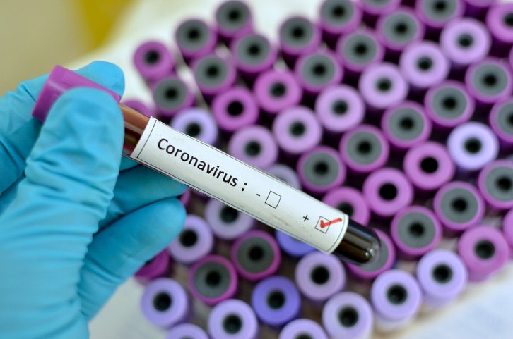  Coronavirusul ar putea scumpi medicamentele în perioada următoare