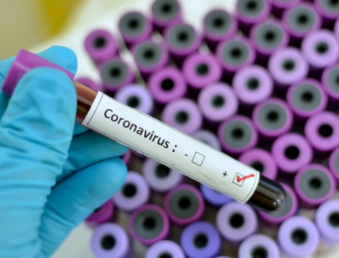  Grecia confirmă primul caz de infectare cu coronavirus