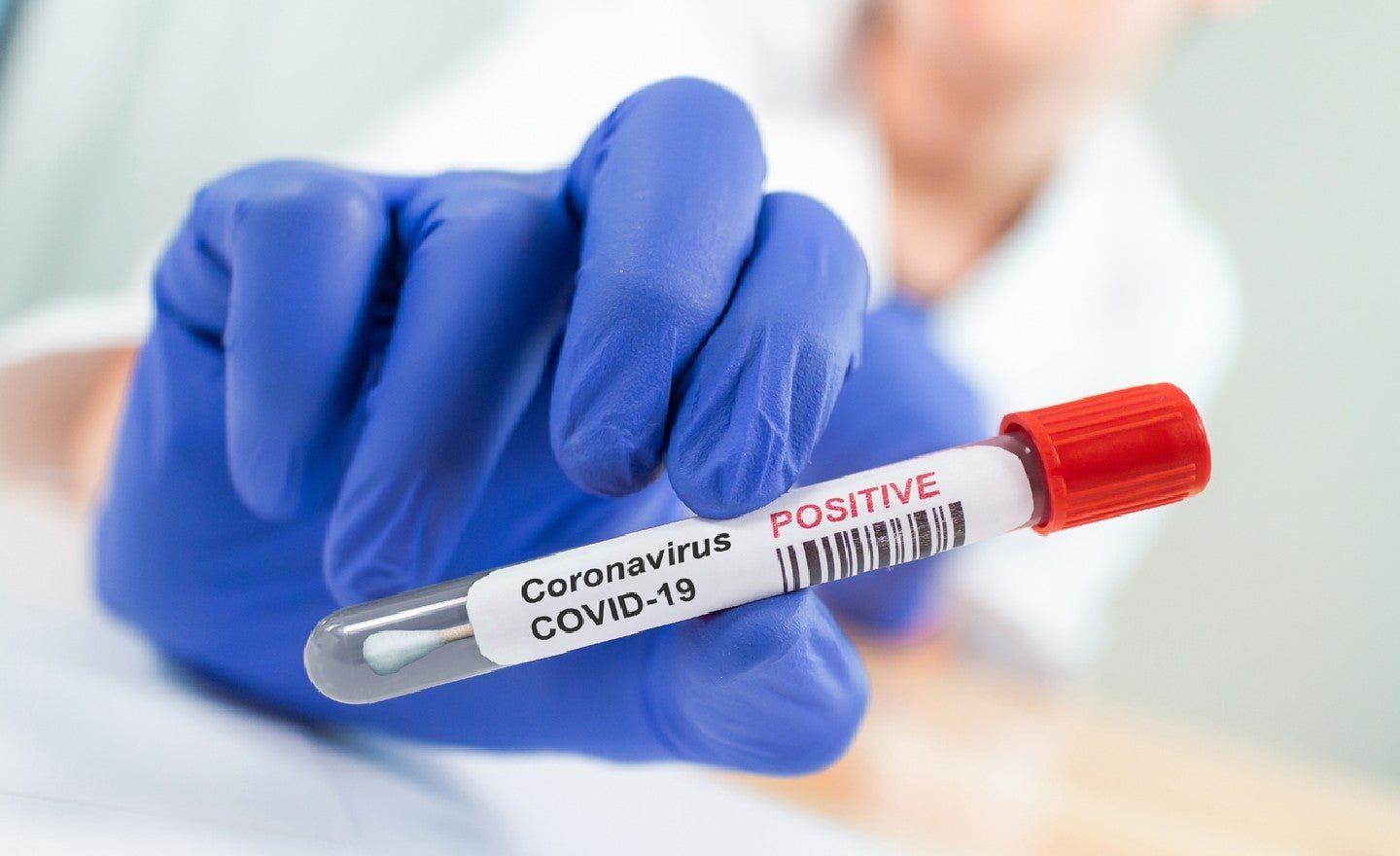  881 de decese provocate de coronavirus. 17 au fost anunțate joi