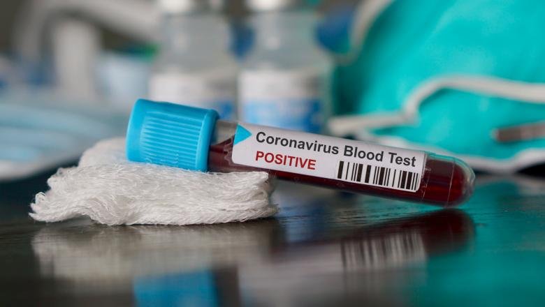  Coronavirus România. Două noi decese anunțate marți dimineața. Numărul total al victimelor: 1207
