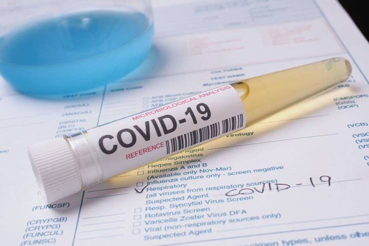  197 de cazuri de persoane infectate cu noul coronavirus în ultimele 24 de ore