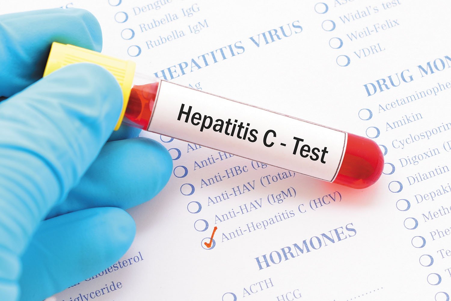  Proiect pentru screeningul infecţiilor cu virusuri hepatitice