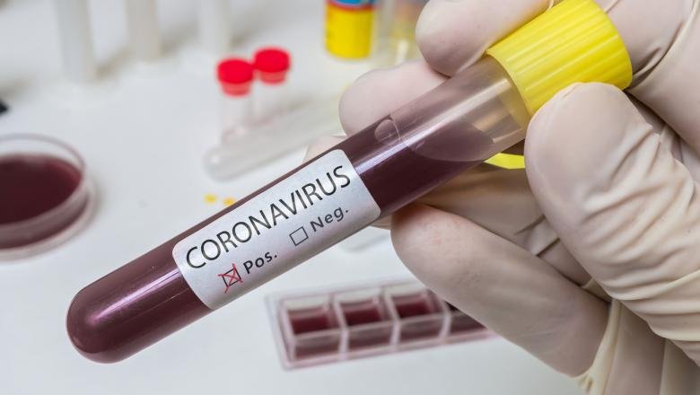 Numărul noilor cazuri de coronavirus înregistrate în România în ultimele 24 de ore este de 125