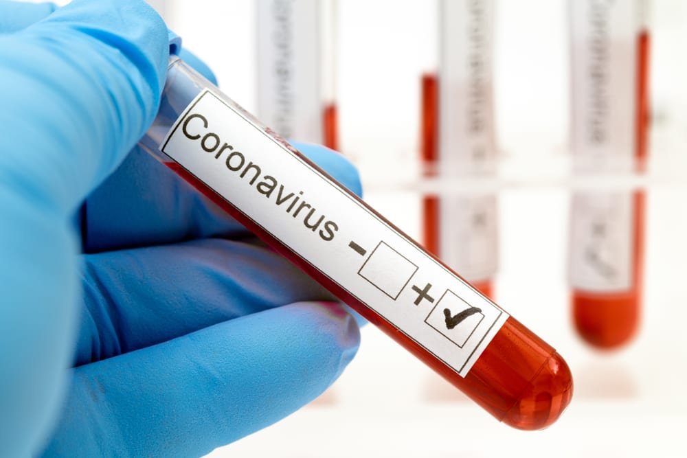  Alte cinci decese provocate de coronavirus. O ieșeancă printre cei morți