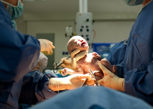  Ce spun medicii de la Neurochirurgie despre cazul femeii care a murit după ce a născut