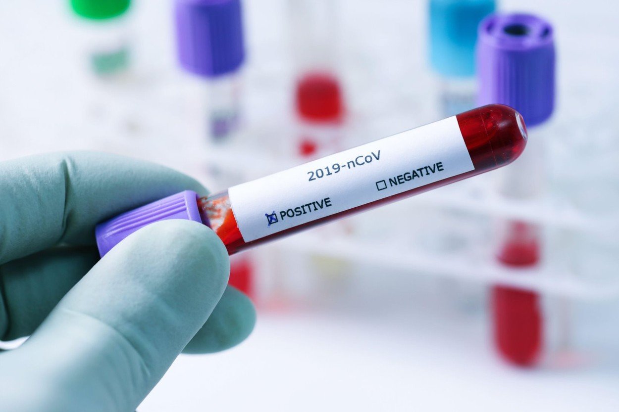  Luxemburg îşi va testa toată populaţia pentru coronavirus