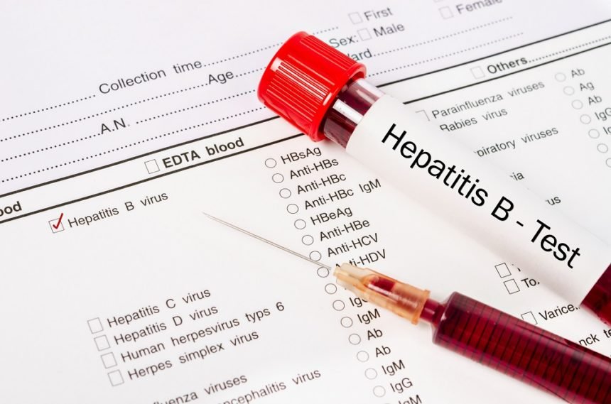  V-aţi făcut un test pentru hepatitele B şi C? Proiecte regionale de screening (P)