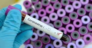  Asimptomaticii au aceeaşi cantitate de coronavirus ca persoanele simptomatice