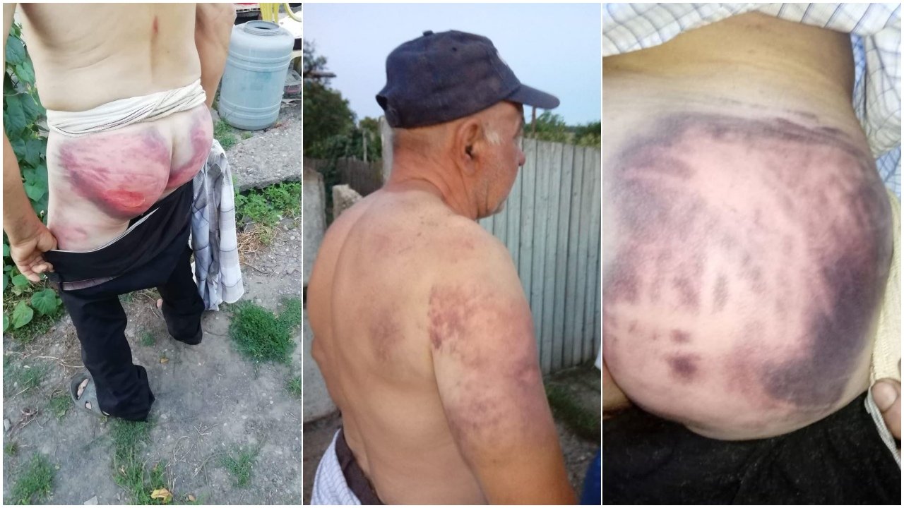  FOTO: Un bărbat acuză că a fost bătut cu bestialitate de şefa de post