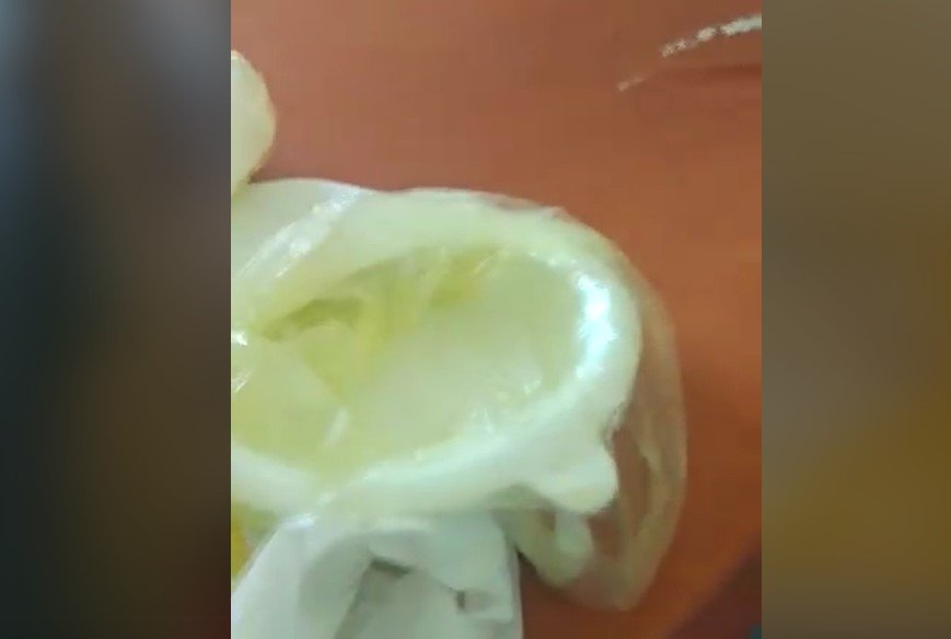  VIDEO-Imagini şocante dintr-un spital de elită: pacienţi obligaţi să-şi facă nevoile într-o pungă