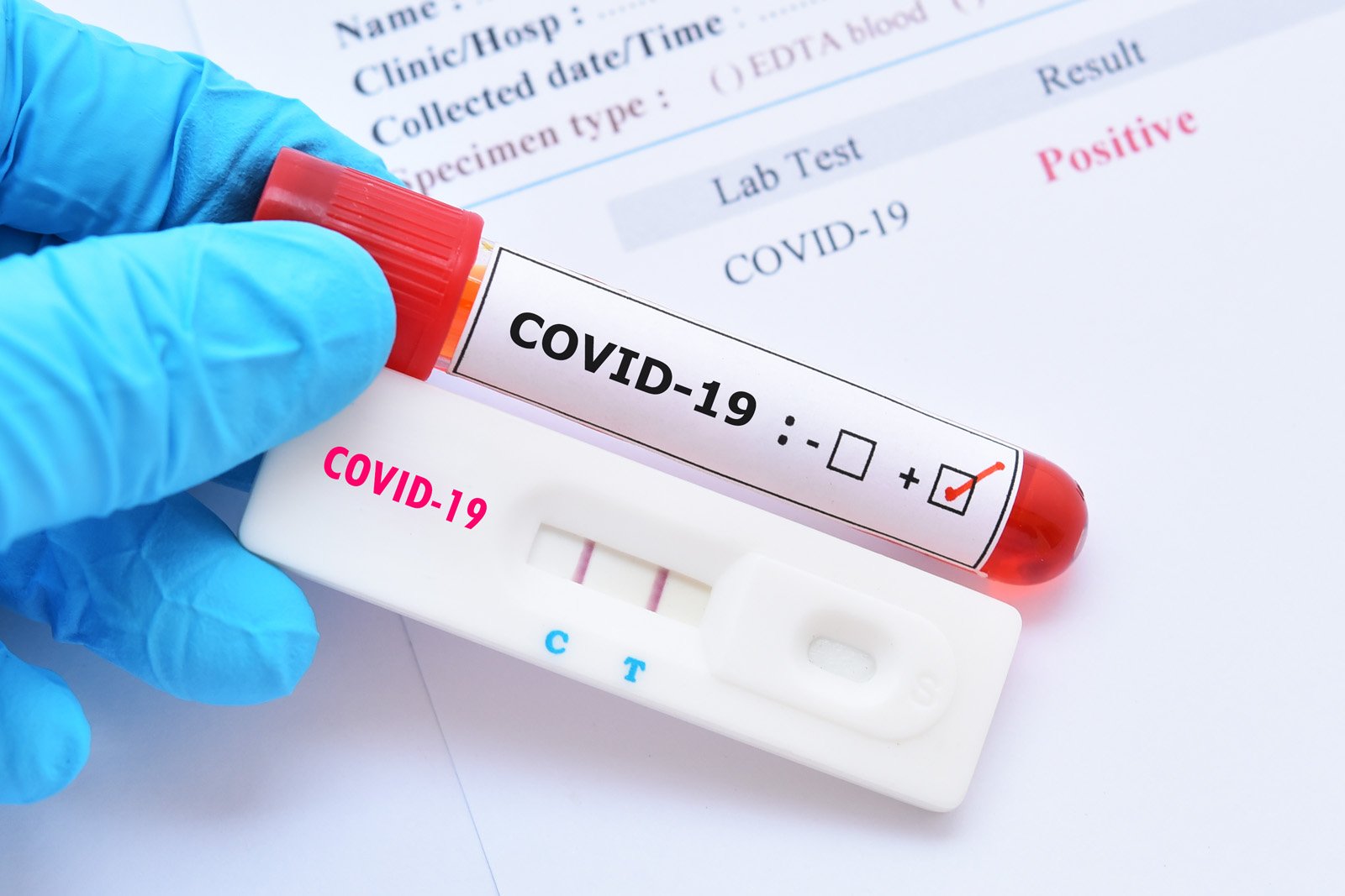  Ce trebuie să faceți dacă aflați că sunteți infectați cu COVID. Cine sunt contacții?