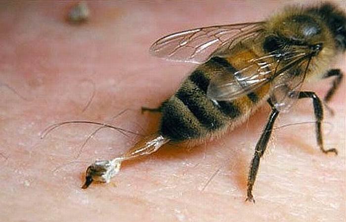  Studiu: Veninul de albină are potenţialul de a distruge celulele cancerului de sân