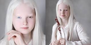  Amina, fetița cu albinism de o frumuseţe nepământeană uimește întreaga lume. A fost descoperită de o fotografă