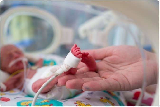  Efect pozitiv al pandemiei: a scăzut numărul copiilor născuţi prematur