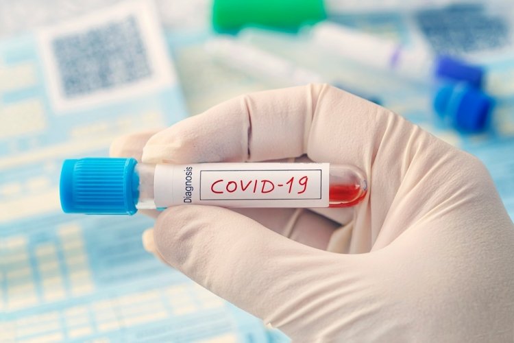  Incidenţa noilor cazuri de coronavirus a scăzut constant în ultimele zile în municipiul Iaşi