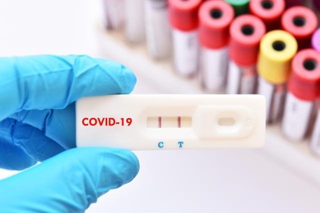  Testele rapide antigen costă între 30 și 68 lei, comparabil cu cele vândute în alte țări – Consiliul Concurenței