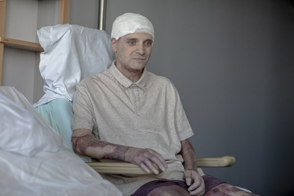  Medicul Cătălin Denciu, ars în spitalul din Piatra Neamț, a revenit temporar acasă