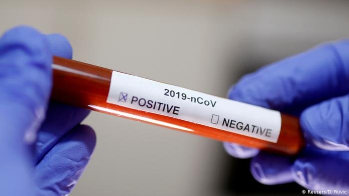  Încă 620 de noi infectări cu noul coronavirus şi 68 de decese în ultimele 24 de ore