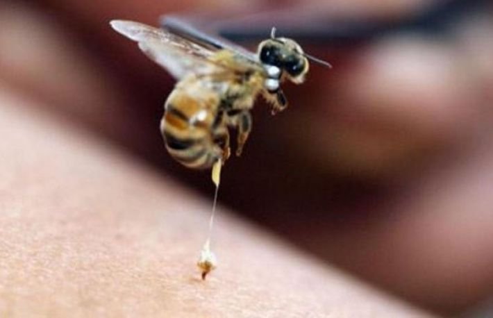  Un ieşean a murit după ce a fost muşcat de o albină. A intrat în şoc anafilactic