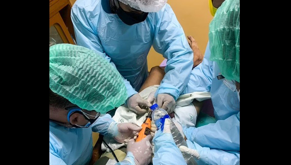  Un bărbat din Thailanda şi-a blocat penisul într-un lacăt timp de două săptămâni. S-a folosit freza!