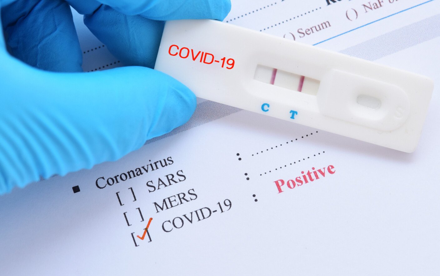  Bilanţ COVID (24 august 2021): Numărul cazurilor zilnice de coronavirus se apropie de 800