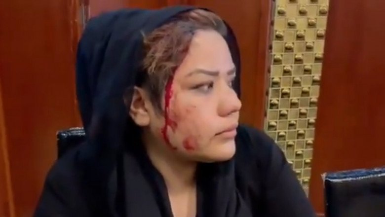  Talibanii au bătut femeile care protestau în Kabul. „Nu suntem femeile anilor ’90”