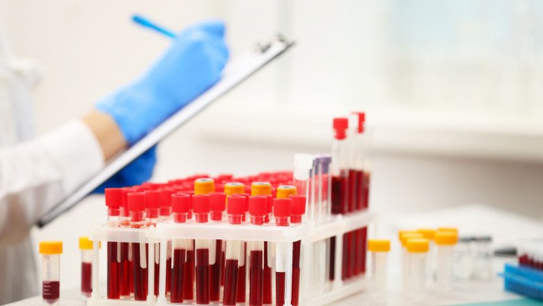  UK a început cel mai mare studiu clinic din lume al unui test de sânge capabil să depisteze peste 50 de tipuri de cancer