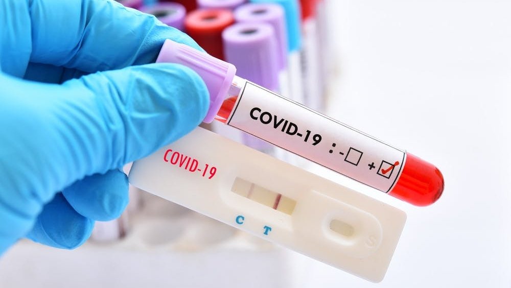  Incidenţa cazurilor de coronavirus creşte în ritm alert în municipiul Iaşi: a sărit de 9 la mia de locuitori