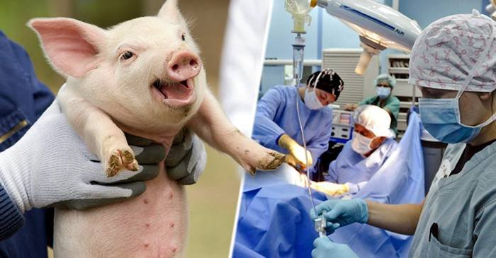  Pas uriaş în medicină: Chirurgii din SUA au transplantat un rinichi de porc unui om