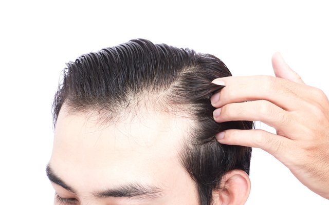 Sfaturi pentru a stopa sau încetinii căderea părului  (P)