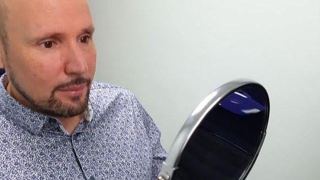 Un britanic urmează să primească primul ochi printat la o imprimantă 3D